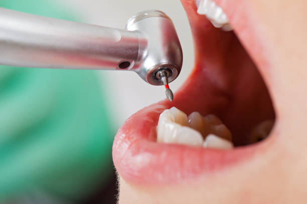 Best Emergency Treatment for Toothache in Fairview, GA